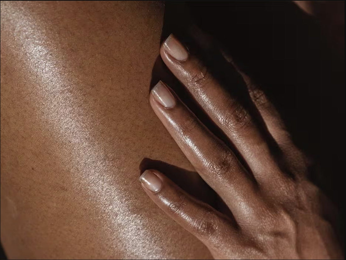 Wie pflege ich meine Haut bei Neurodermitis?